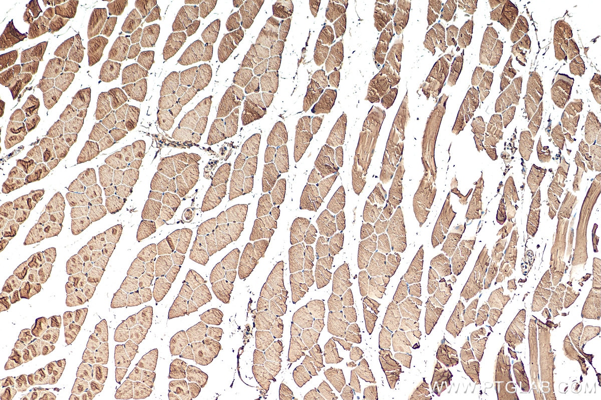 Immunohistochemistry (IHC) staining of mouse skeletal muscle tissue using TNNI2 Polyclonal antibody (22130-1-AP)