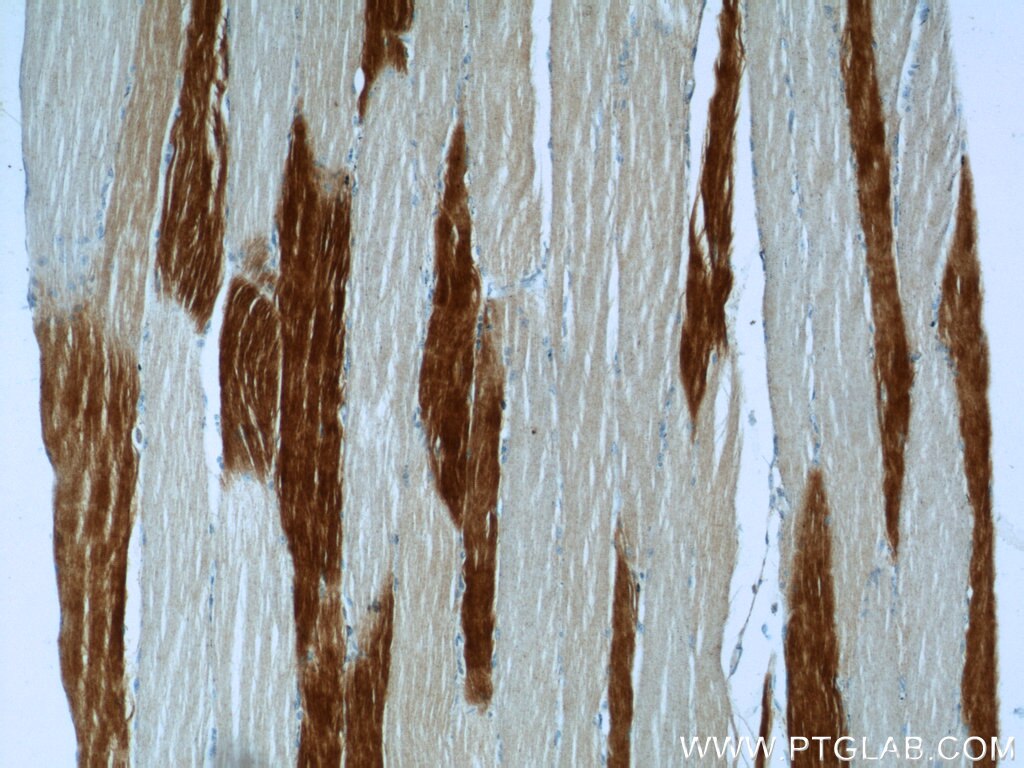 Immunohistochemistry (IHC) staining of human skeletal muscle tissue using TNNI2 Polyclonal antibody (22130-1-AP)