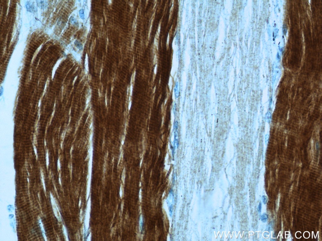 Immunohistochemistry (IHC) staining of human skeletal muscle tissue using TNNI2 Polyclonal antibody (22130-1-AP)