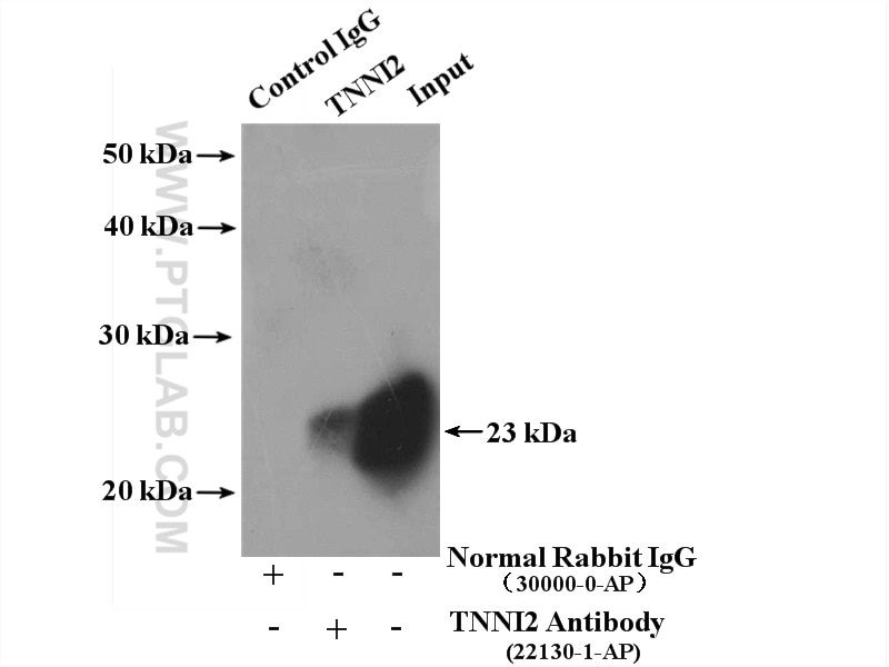 Immunoprecipitation (IP) experiment of mouse skeletal muscle tissue using TNNI2 Polyclonal antibody (22130-1-AP)