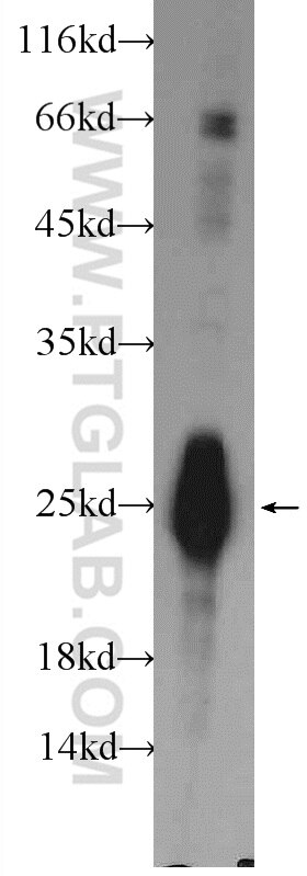 WB analysis of rat skeletal muscle using 22130-1-AP