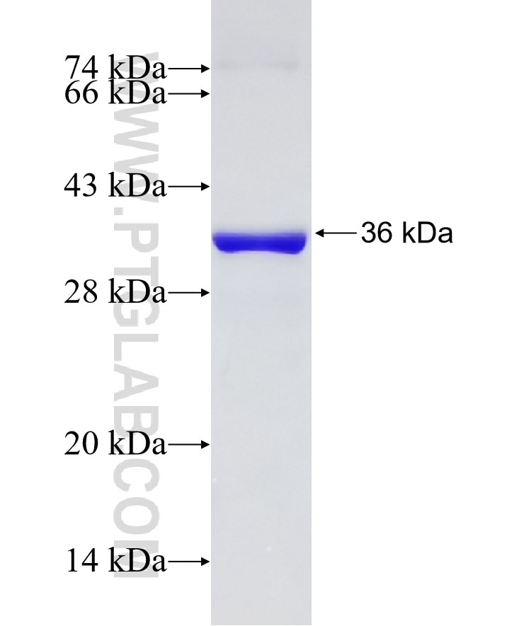 TNNI2 fusion protein Ag17750 SDS-PAGE