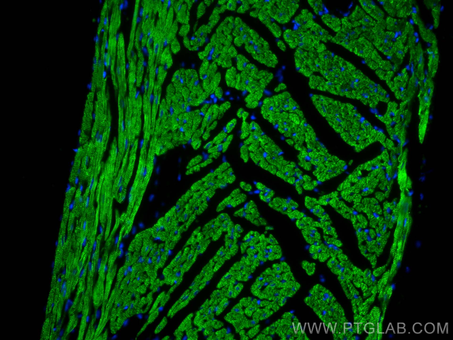 IF Staining of mouse heart using 21652-1-AP