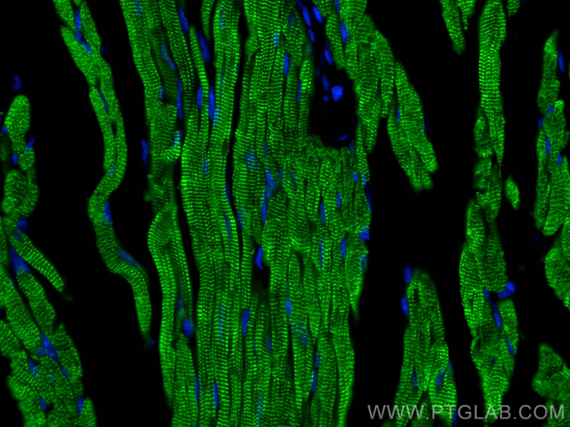 IF Staining of mouse heart using 21652-1-AP