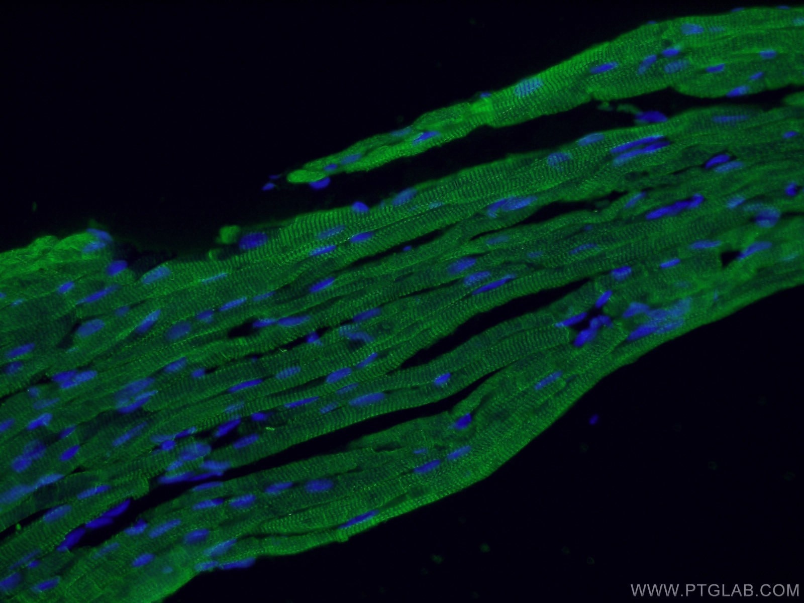 Immunofluorescence (IF) / fluorescent staining of mouse heart tissue using Cardiac Troponin I Polyclonal antibody (21652-1-AP)