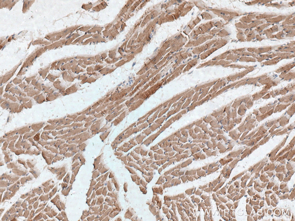 Immunohistochemistry (IHC) staining of mouse heart tissue using Cardiac Troponin I Polyclonal antibody (21652-1-AP)