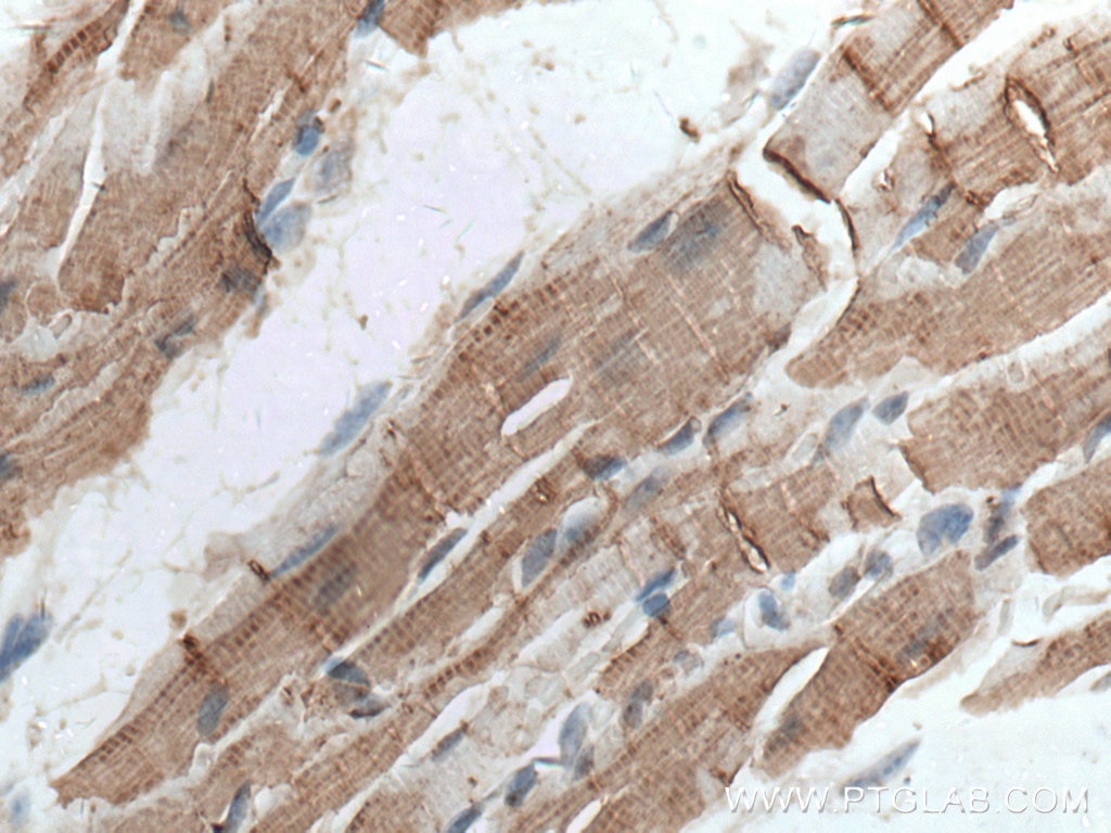 Immunohistochemistry (IHC) staining of mouse heart tissue using Cardiac Troponin I Polyclonal antibody (21652-1-AP)