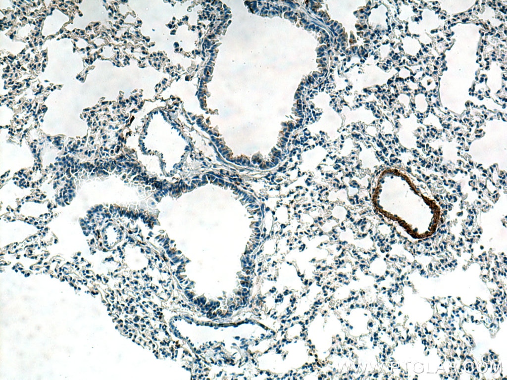 Immunohistochemistry (IHC) staining of mouse lung tissue using Cardiac Troponin I Polyclonal antibody (21652-1-AP)