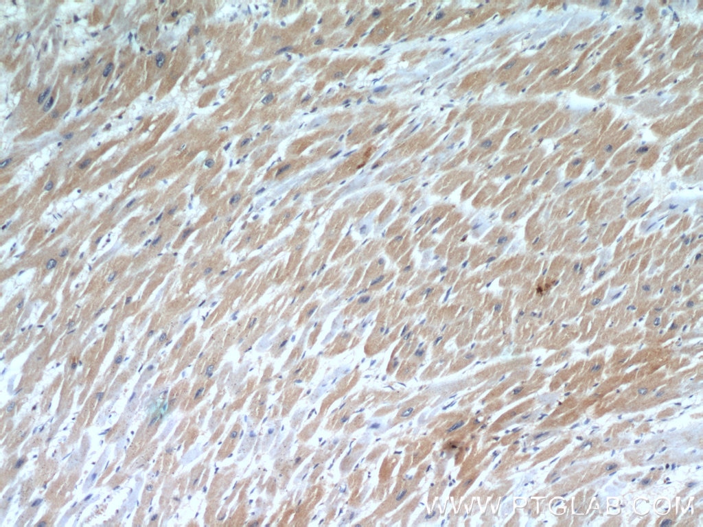 Immunohistochemistry (IHC) staining of human heart tissue using Cardiac Troponin I Polyclonal antibody (21652-1-PBS)