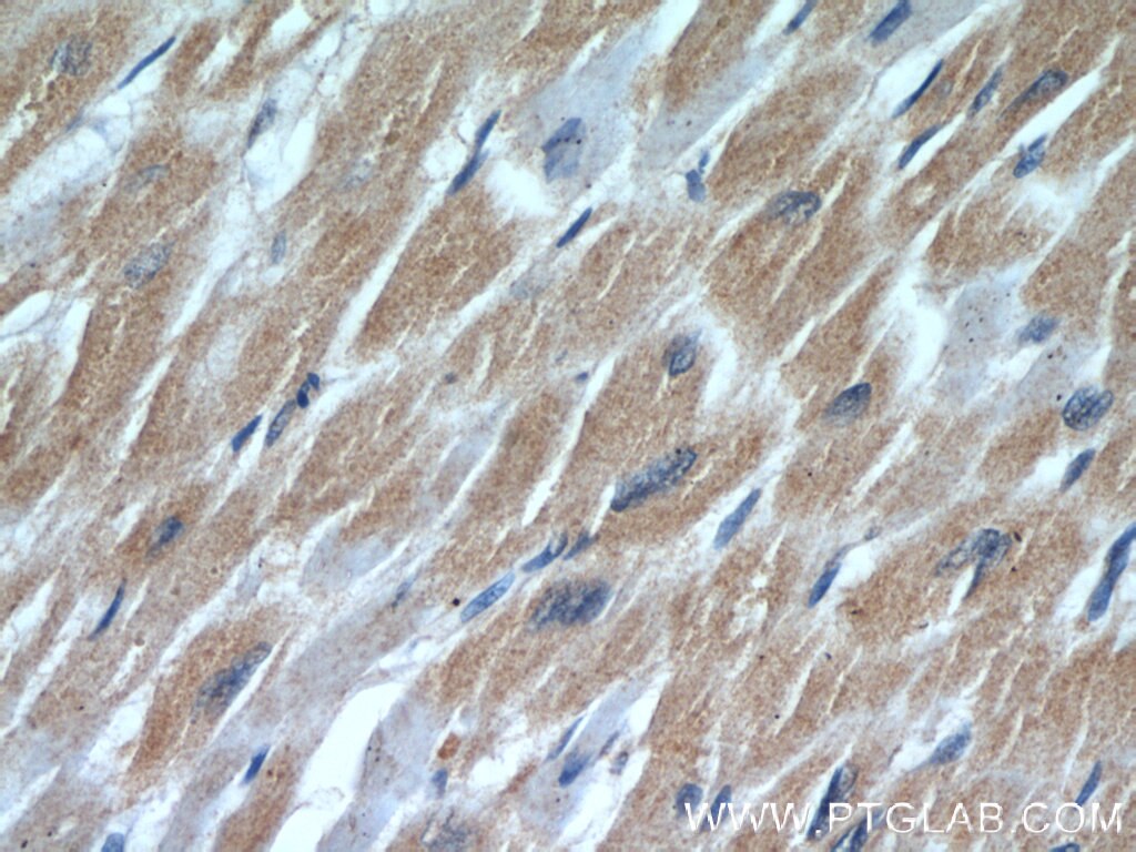 Immunohistochemistry (IHC) staining of human heart tissue using Cardiac Troponin I Polyclonal antibody (21652-1-PBS)