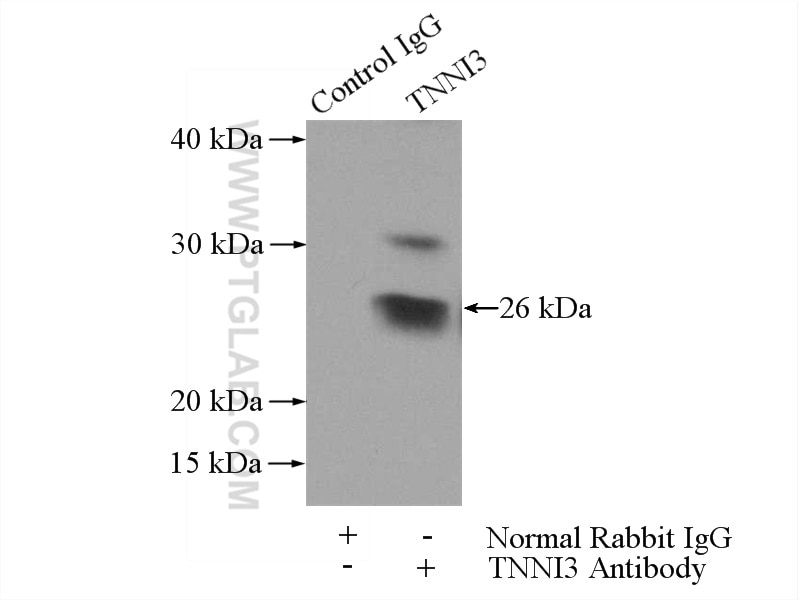 Immunoprecipitation (IP) experiment of mouse heart tissue using Cardiac Troponin I Polyclonal antibody (21652-1-AP)