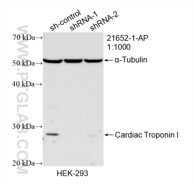Western Blot (WB) analysis of HEK-293 cells using Cardiac Troponin I Polyclonal antibody (21652-1-AP)