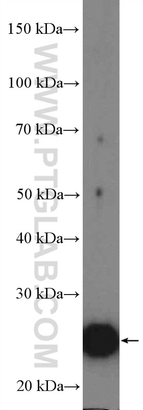 Western Blot (WB) analysis of mouse heart tissue using Cardiac Troponin I Polyclonal antibody (21652-1-AP)