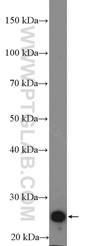 Western Blot (WB) analysis of rat heart tissue using Cardiac Troponin I Polyclonal antibody (21652-1-AP)