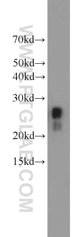 Cardiac Troponin I Polyclonal antibody