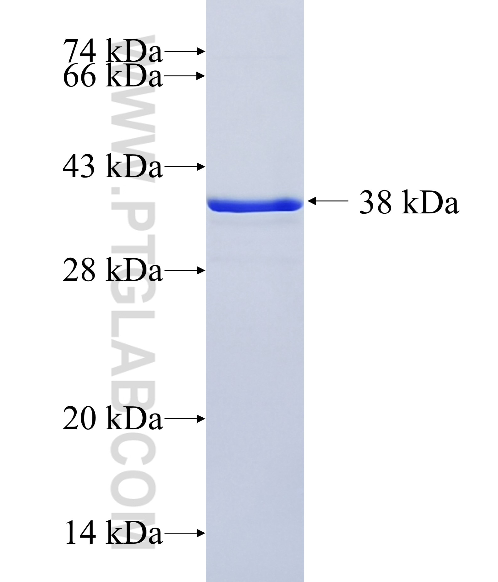 TNNI3 fusion protein Ag16365 SDS-PAGE