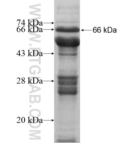 TNNI3K fusion protein Ag11887 SDS-PAGE