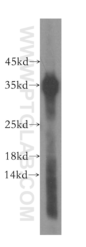 Western Blot (WB) analysis of human skeletal muscle tissue using TNNT1 Polyclonal antibody (15893-1-AP)