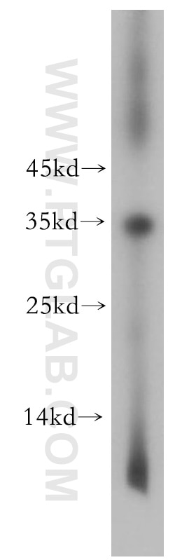 Western Blot (WB) analysis of mouse skeletal muscle tissue using TNNT1 Polyclonal antibody (15893-1-AP)