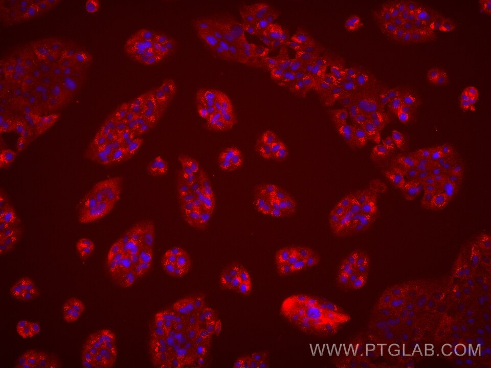 Immunofluorescence (IF) / fluorescent staining of hTERT-RPE1 cells using TNNT1 Monoclonal antibody (68631-1-Ig)