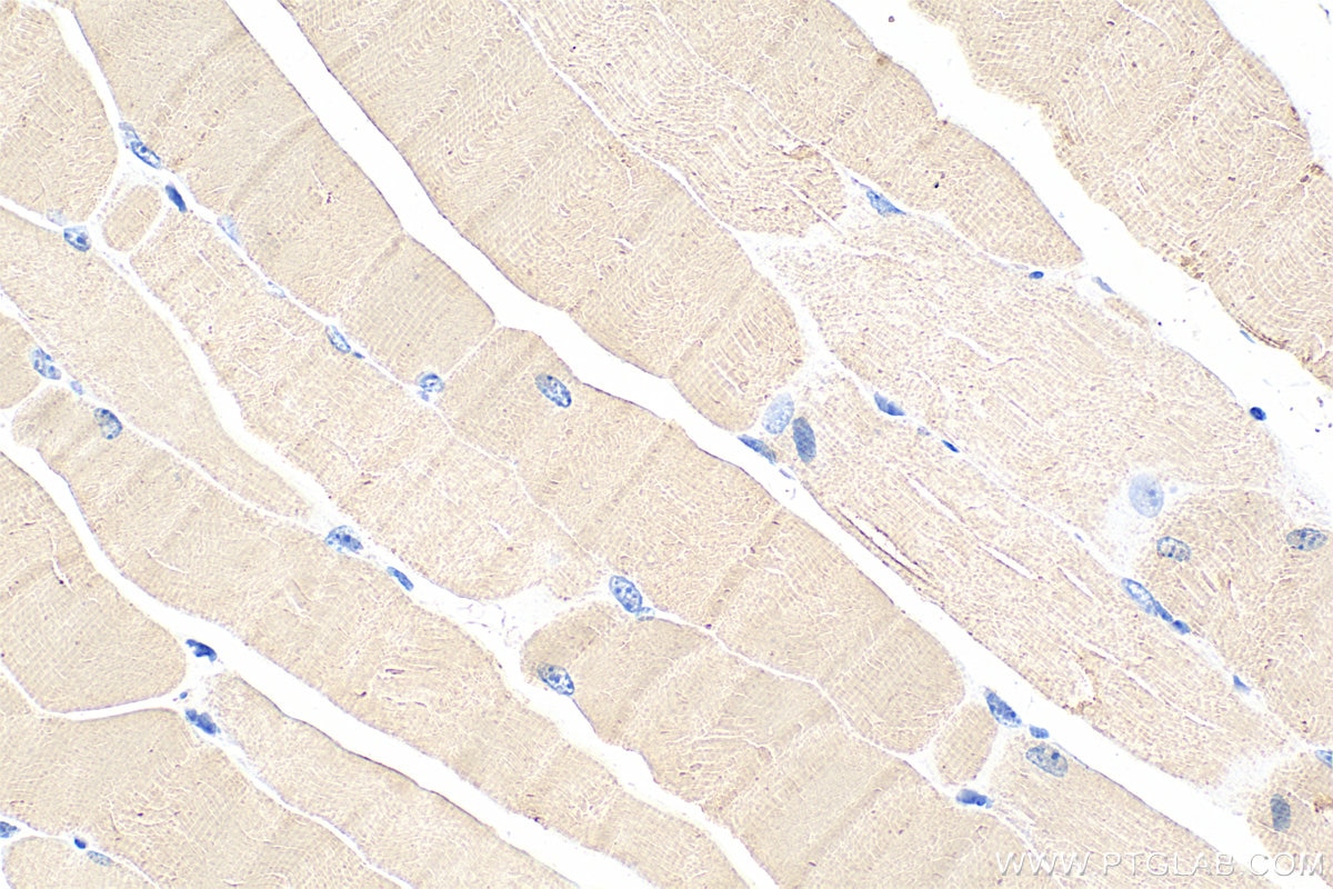 Immunohistochemistry (IHC) staining of mouse skeletal muscle tissue using TNNT1 Monoclonal antibody (68631-1-Ig)