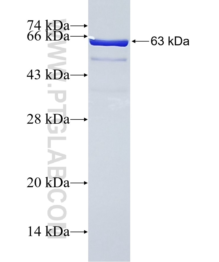 TNNT1 fusion protein Ag8702 SDS-PAGE