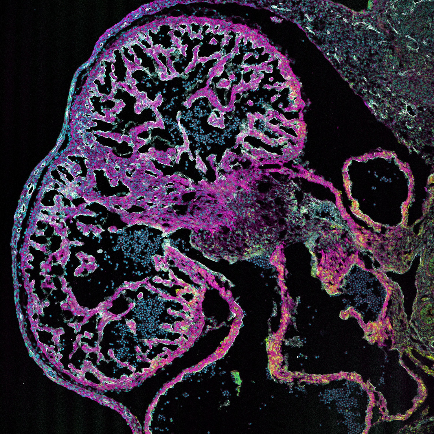 IF Staining of mouse heart using 15513-1-AP