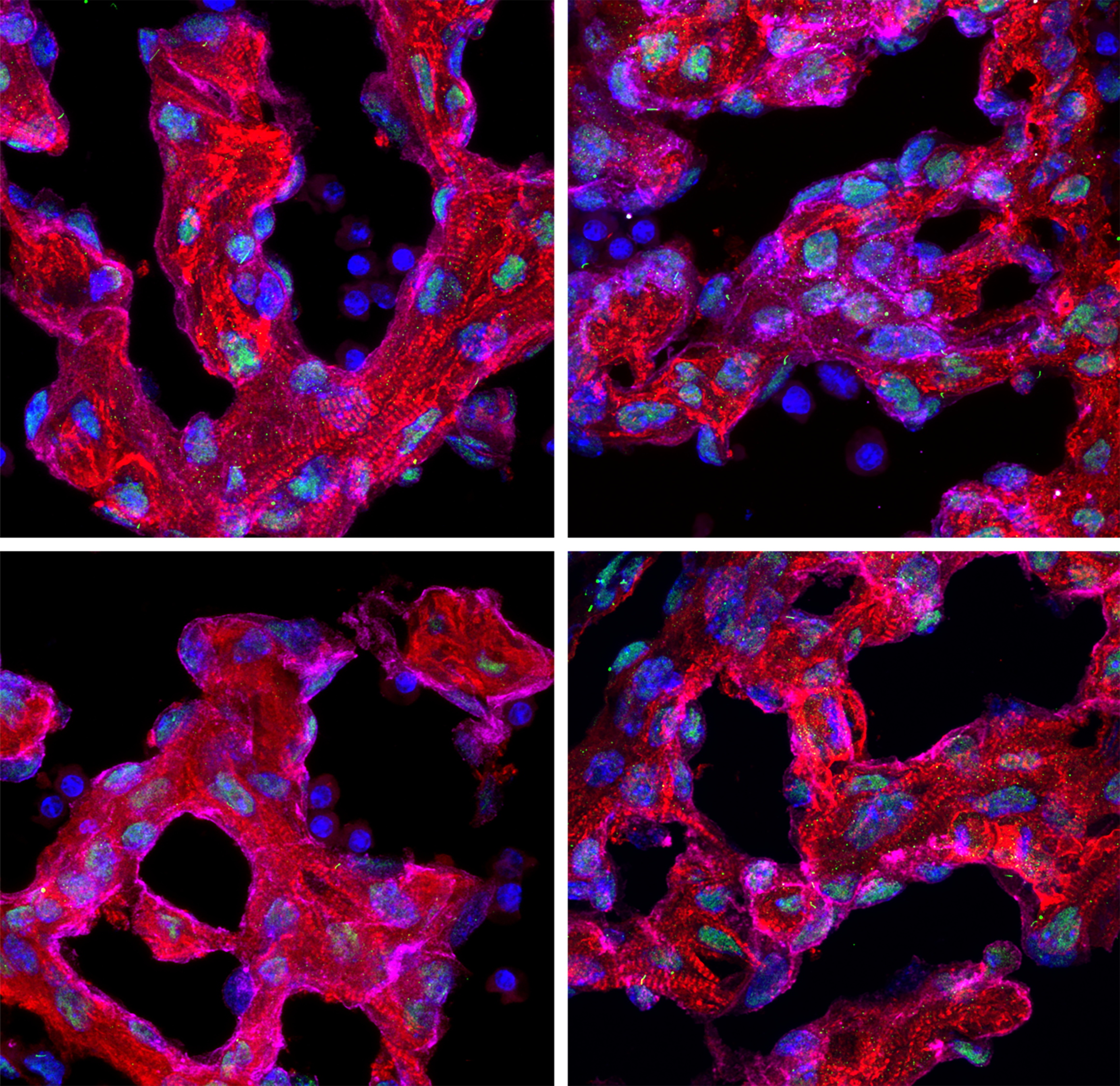 Immunofluorescence (IF) / fluorescent staining of mouse heart tissue using Cardiac Troponin T Polyclonal antibody (15513-1-AP)