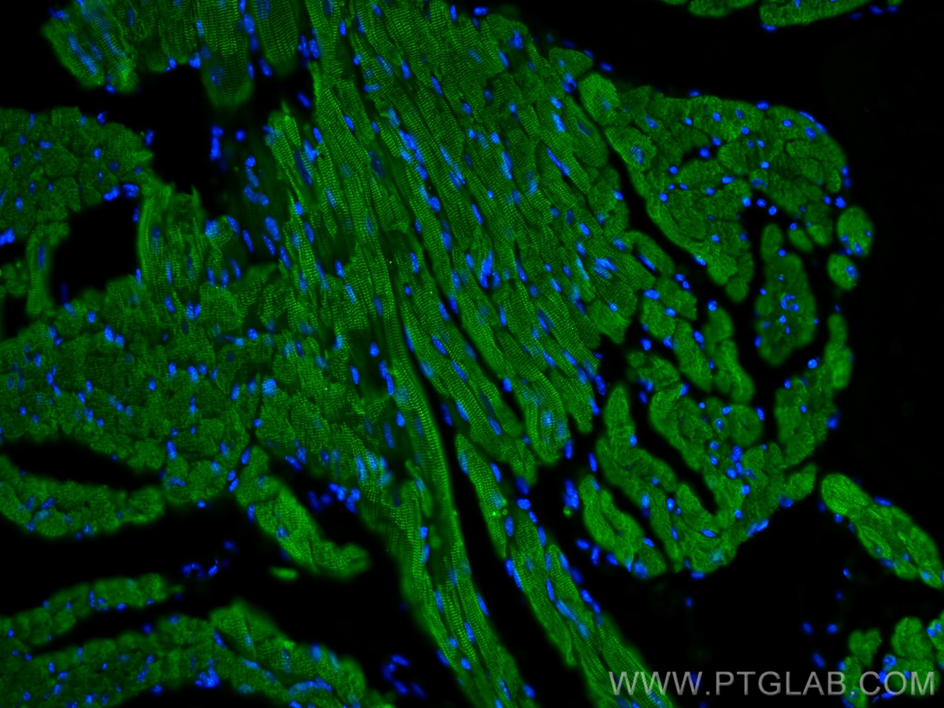 Immunofluorescence (IF) / fluorescent staining of mouse heart tissue using Cardiac Troponin T Polyclonal antibody (15513-1-AP)