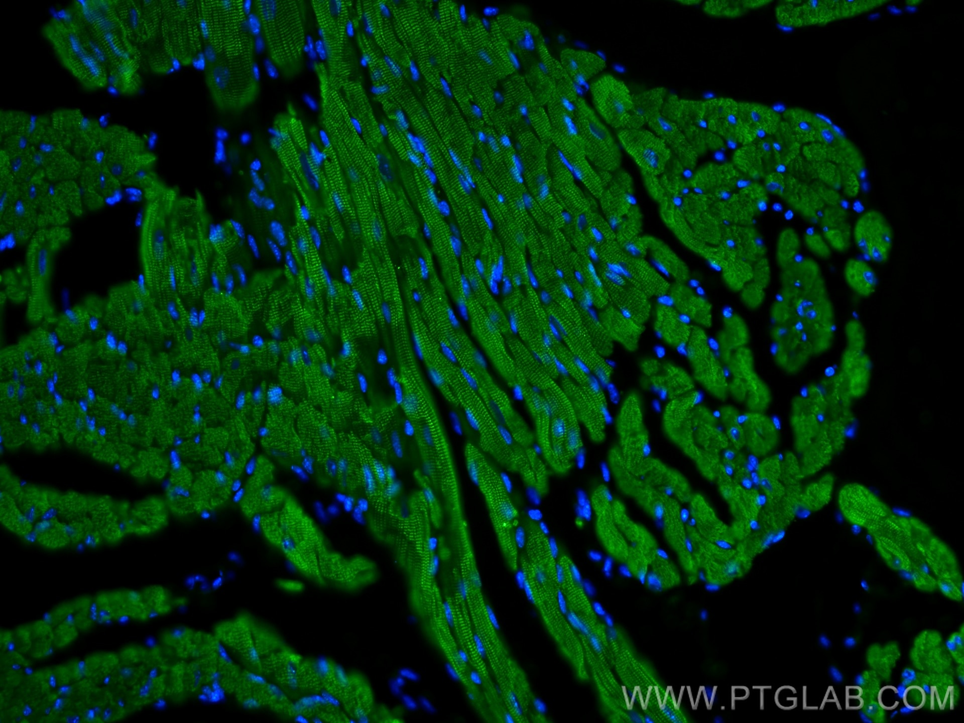 IF Staining of mouse heart using 15513-1-AP