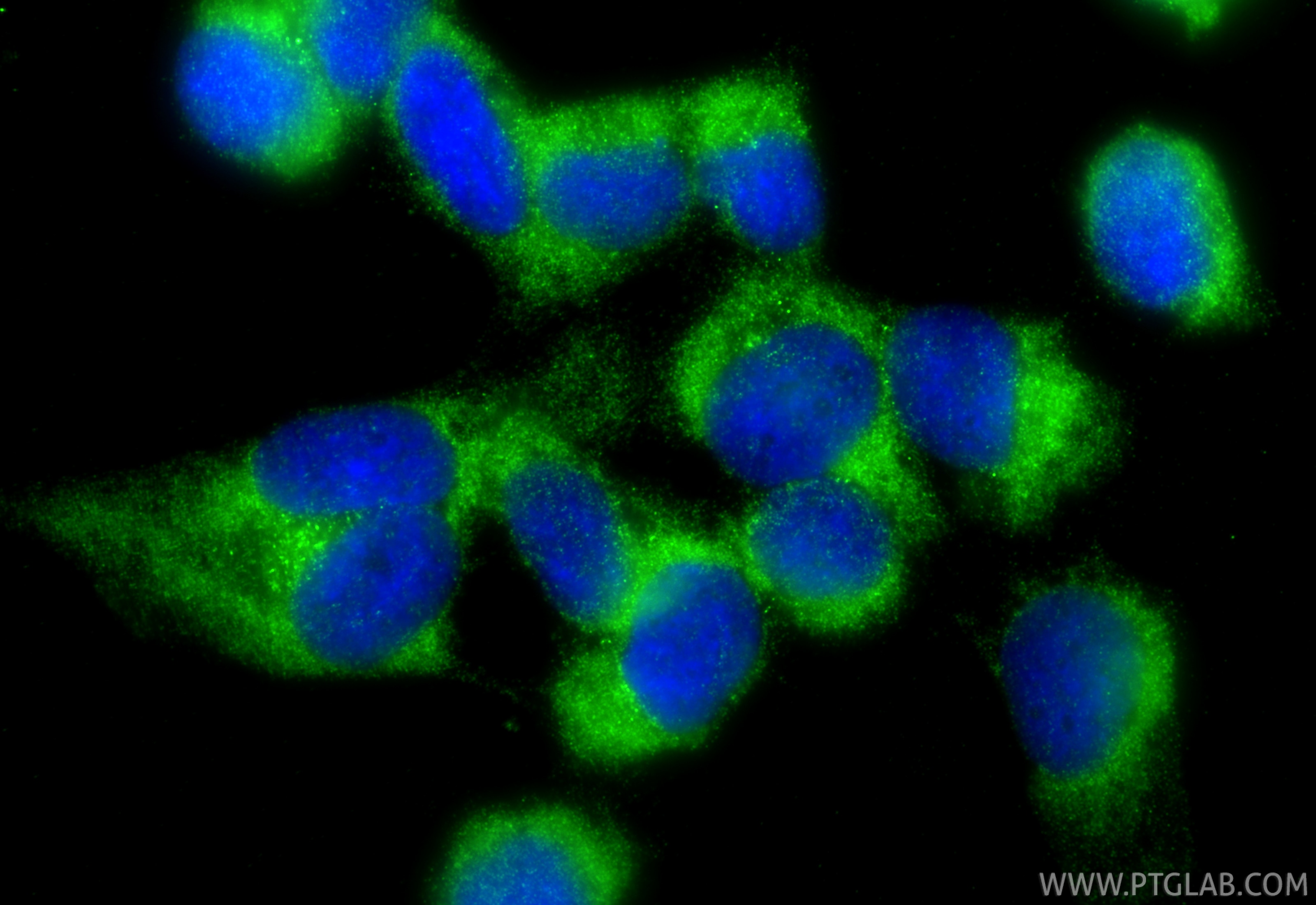 Immunofluorescent analysis of (-20°C Methanol) fixed AC16 cells using Cardiac Troponin T antibody (15513-1-AP) at dilution of 1:200 and CoraLite®488-Conjugated Goat Anti-Rabbit IgG(H+L) (SA00013-2). Immunofluorescence (IF) / fluorescent staining of AC16 cells using Cardiac Troponin T Polyclonal antibody (15513-1-AP)