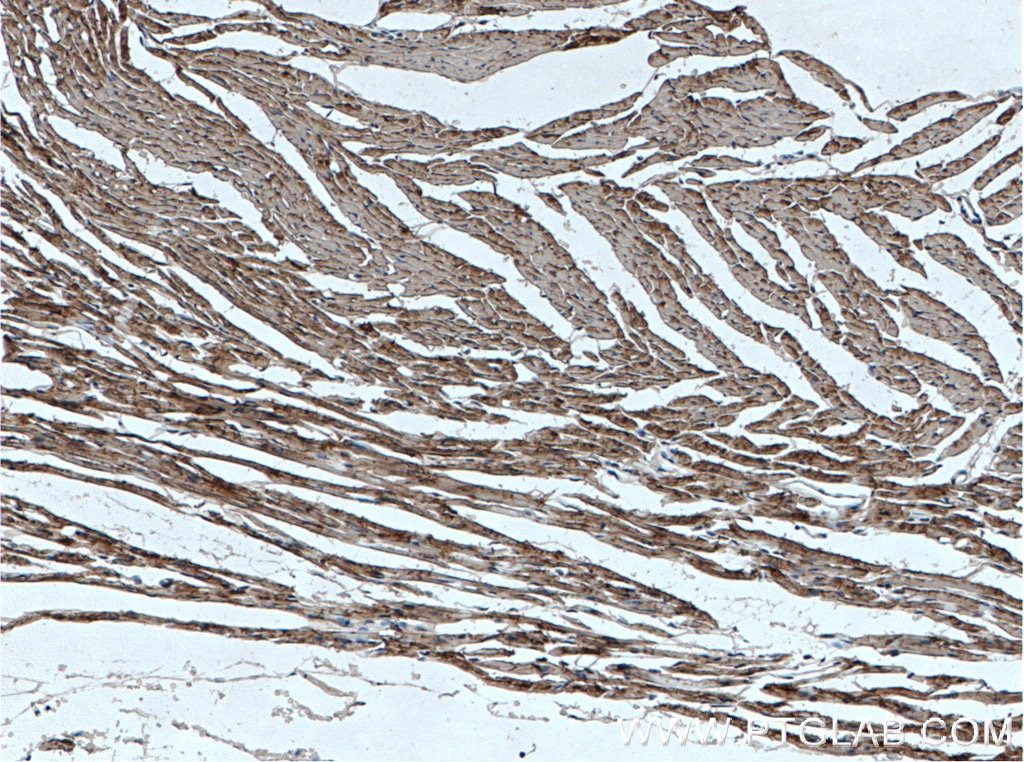 IHC staining of mouse heart using 15513-1-AP