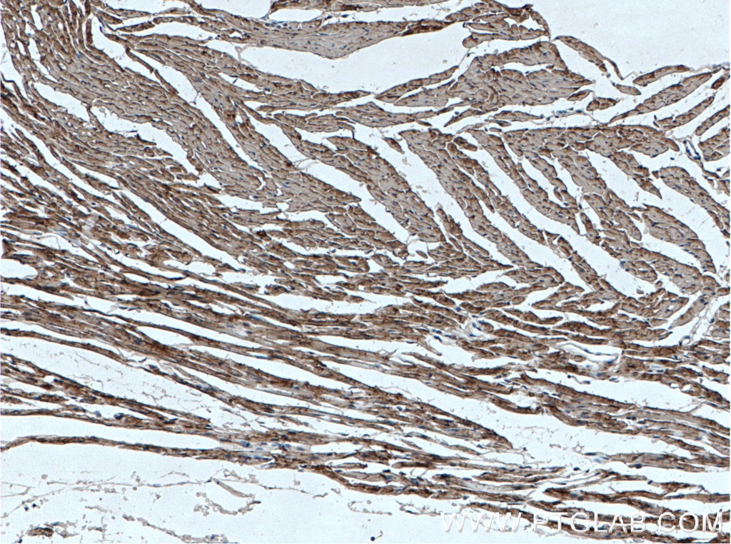 Immunohistochemistry (IHC) staining of mouse heart tissue using Cardiac Troponin T Polyclonal antibody (15513-1-AP)