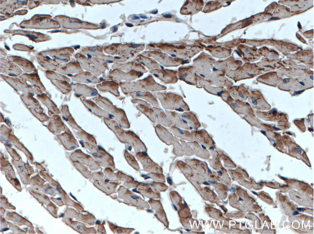 IHC staining of mouse heart using 15513-1-AP