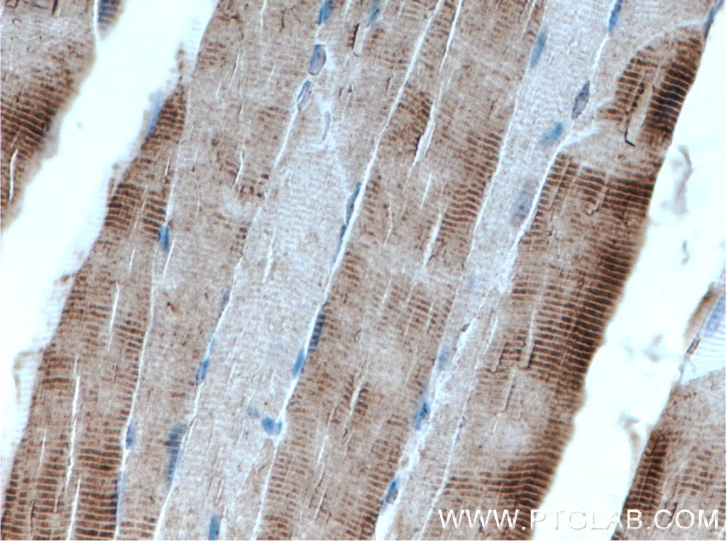 Immunohistochemistry (IHC) staining of mouse skeletal muscle tissue using Cardiac Troponin T Polyclonal antibody (15513-1-AP)