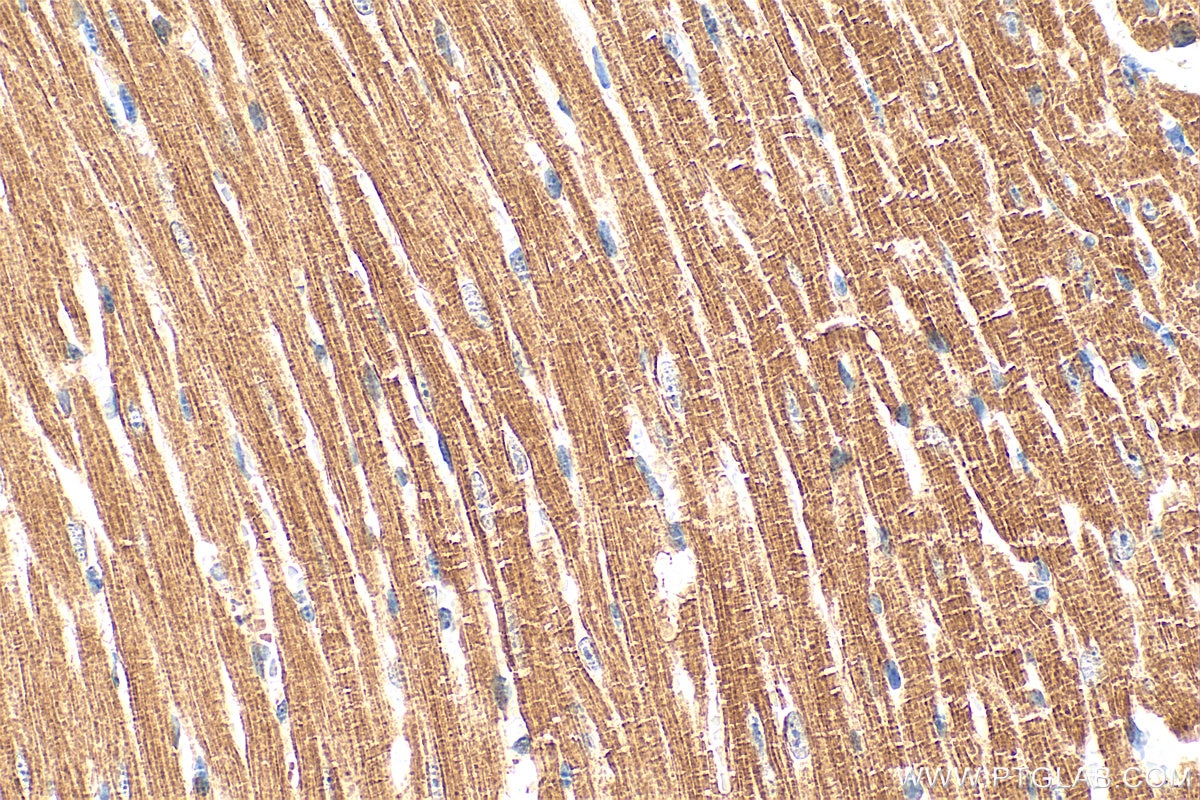 Immunohistochemistry (IHC) staining of mouse heart tissue using Cardiac Troponin T Polyclonal antibody (15513-1-AP)