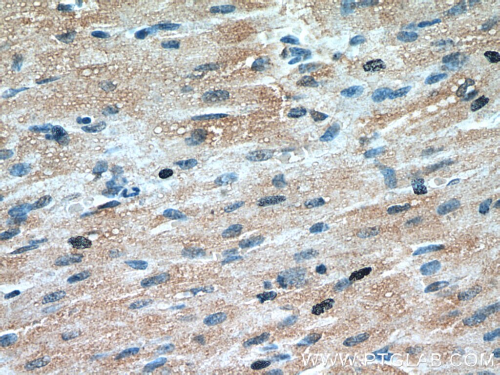 Cardiac Troponin T Polyclonal antibody