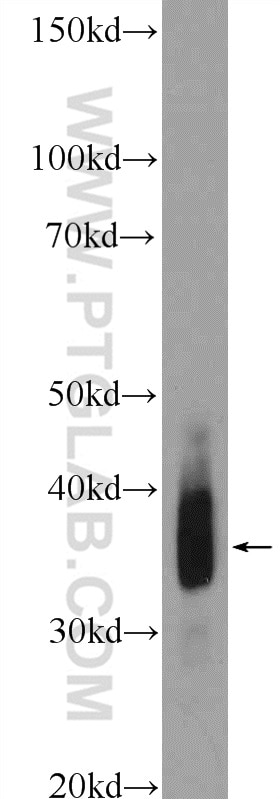 Western Blot (WB) analysis of rat heart tissue using Cardiac Troponin T Polyclonal antibody (15513-1-AP)