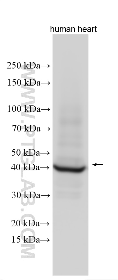 WB analysis using 15513-1-AP Western Blot (WB) analysis of various lysates using Cardiac Troponin T Polyclonal antibody (15513-1-AP)