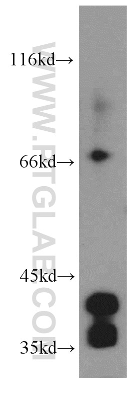 Western Blot (WB) analysis of human heart tissue using Cardiac Troponin T Polyclonal antibody (15513-1-AP)