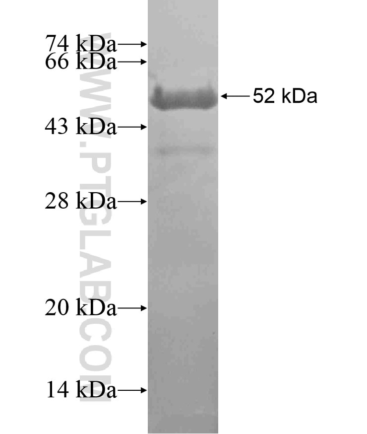 TNNT2 fusion protein Ag17751 SDS-PAGE