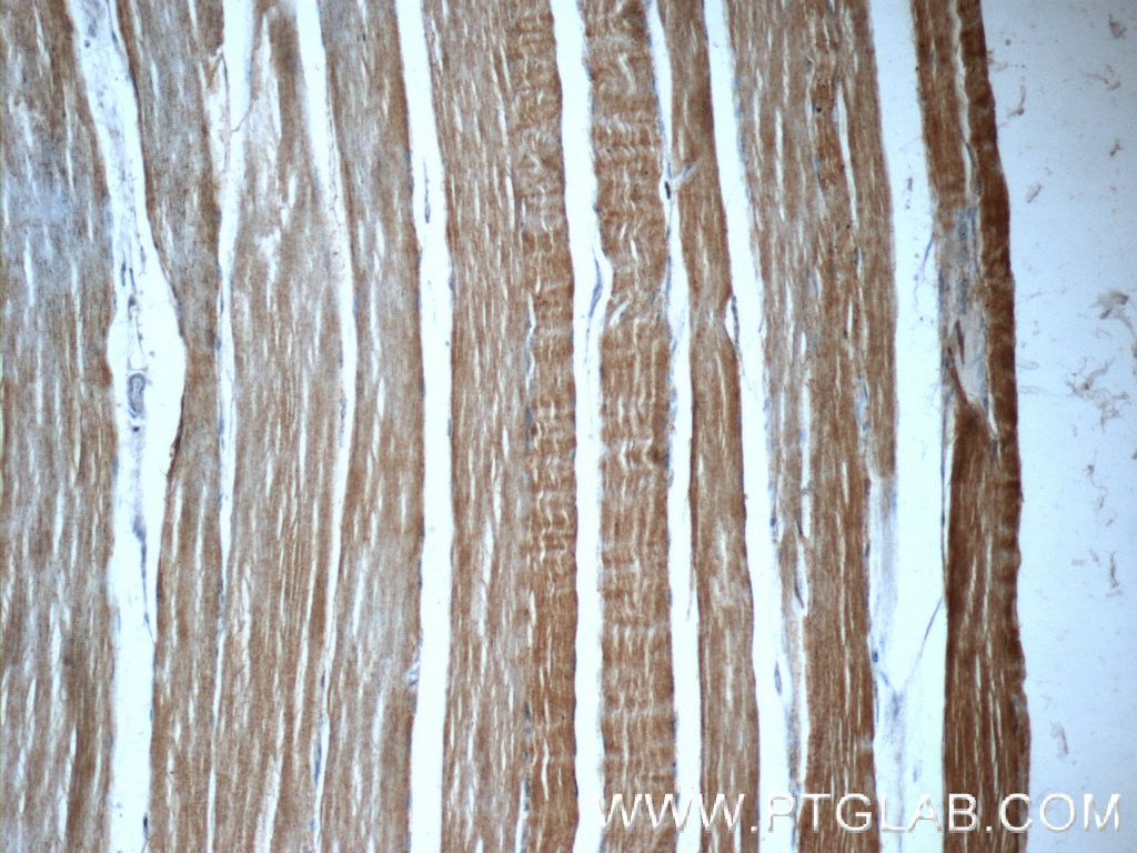 Immunohistochemistry (IHC) staining of human skeletal muscle tissue using TNNT3 Polyclonal antibody (19729-1-AP)