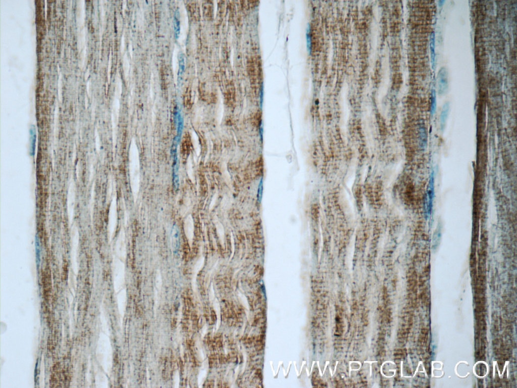 Immunohistochemistry (IHC) staining of human skeletal muscle tissue using TNNT3 Polyclonal antibody (19729-1-AP)