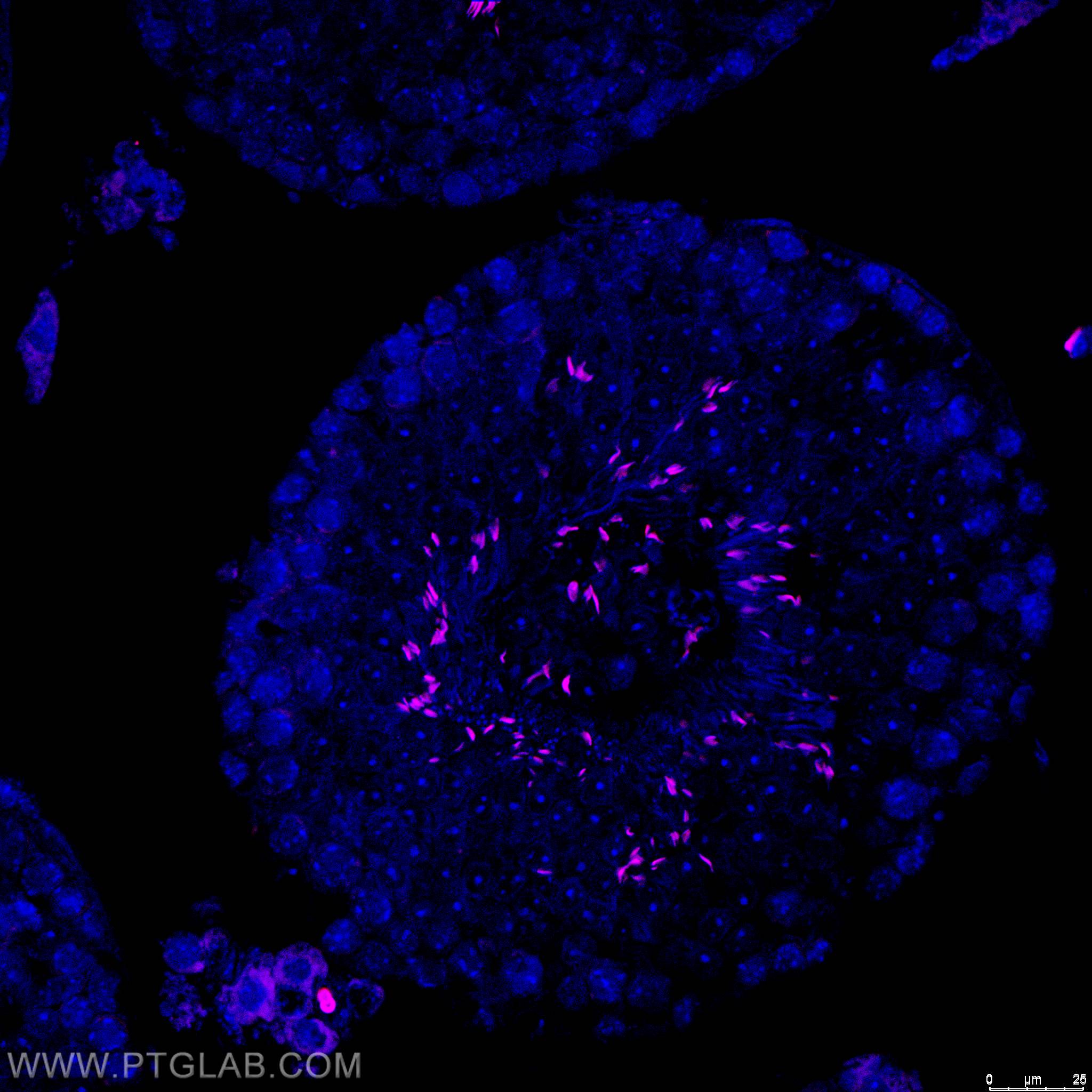 Immunofluorescence (IF) / fluorescent staining of mouse testis tissue using CoraLite®555-conjugated TNP1 Polyclonal antibody (CL555-17178)