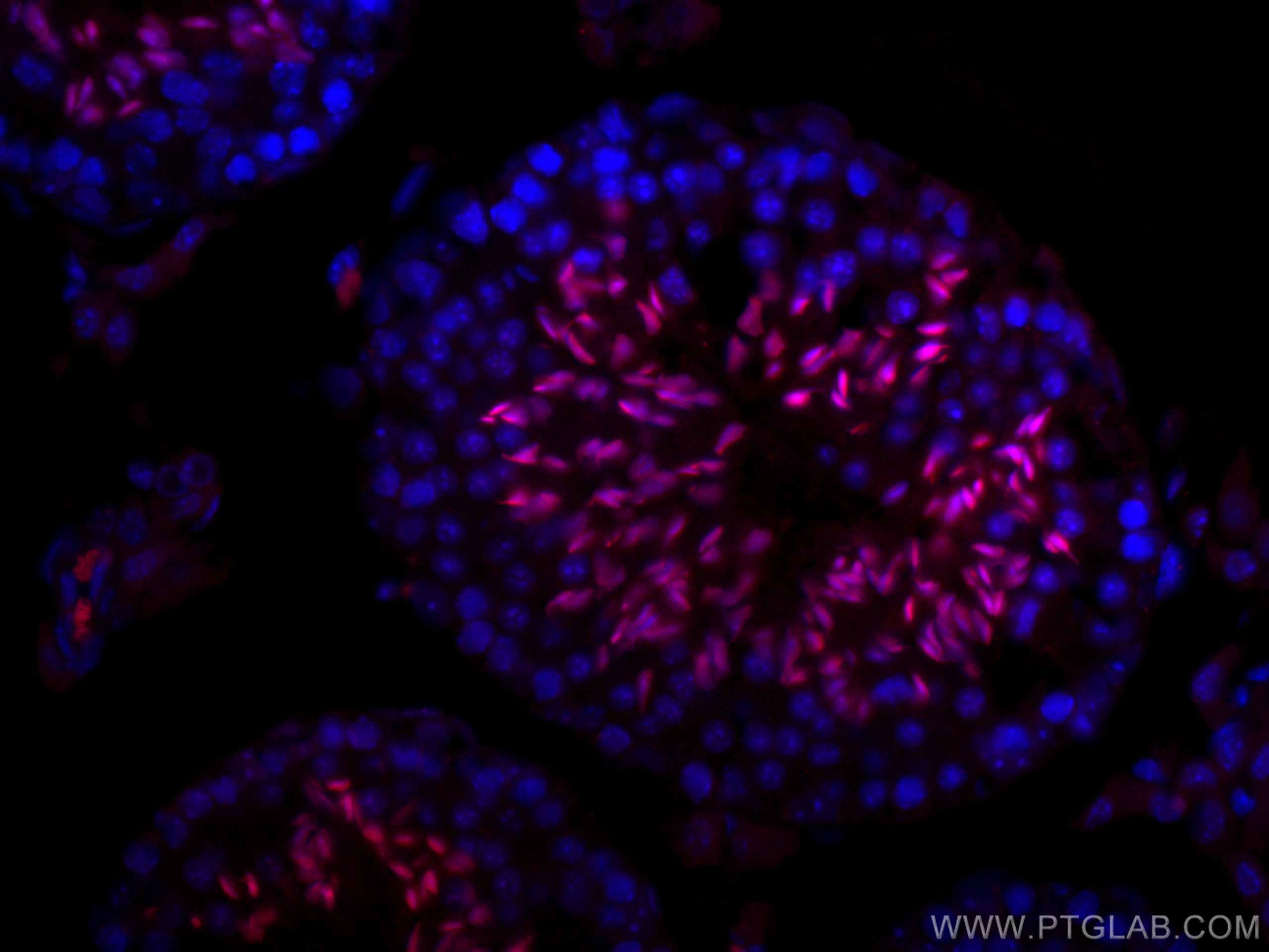 IF Staining of mouse testis using CL647-17178