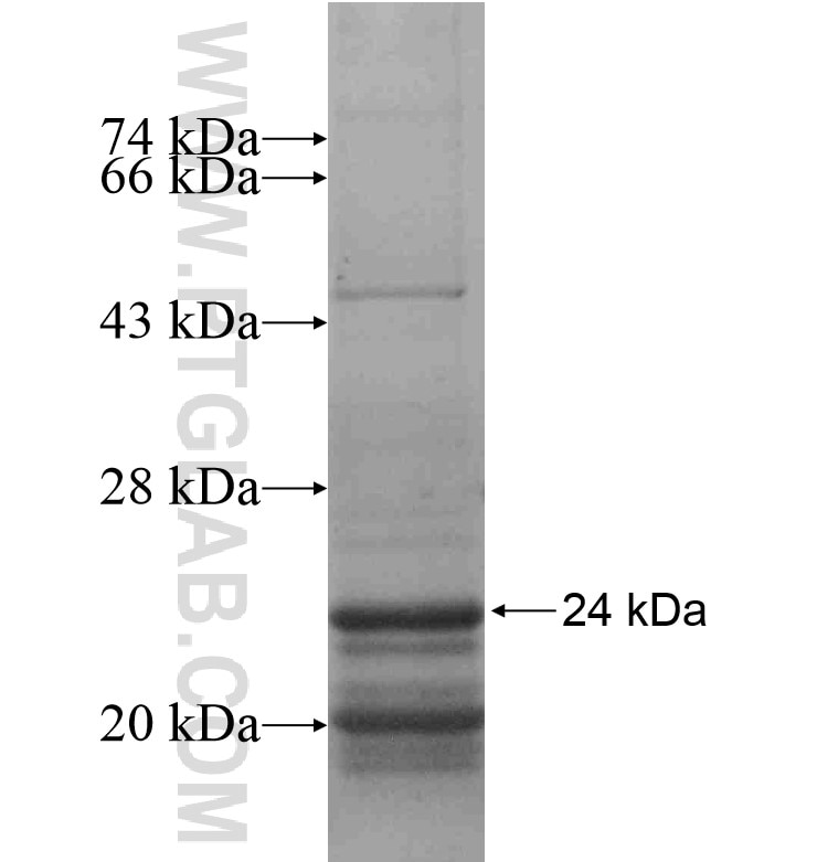 TNP2 fusion protein Ag16762 SDS-PAGE