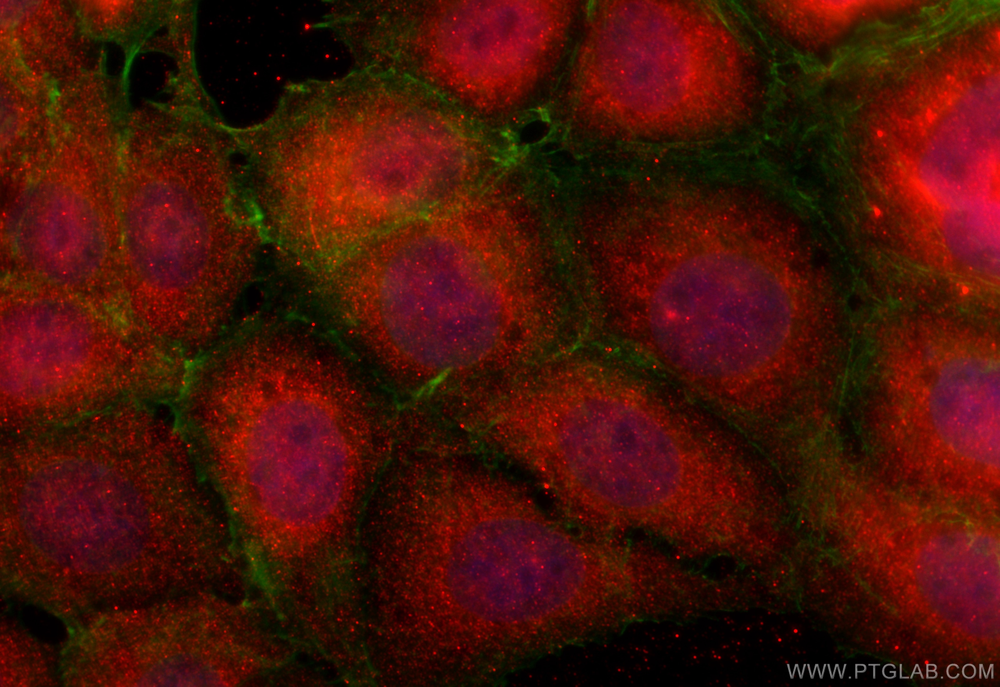 Immunofluorescence (IF) / fluorescent staining of MCF-7 cells using TNPO1 Polyclonal antibody (20679-1-AP)