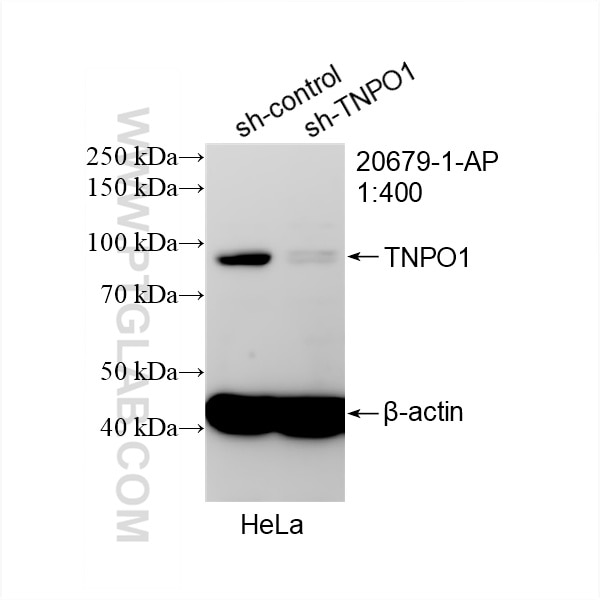Western Blot (WB) analysis of HeLa cells using TNPO1 Polyclonal antibody (20679-1-AP)