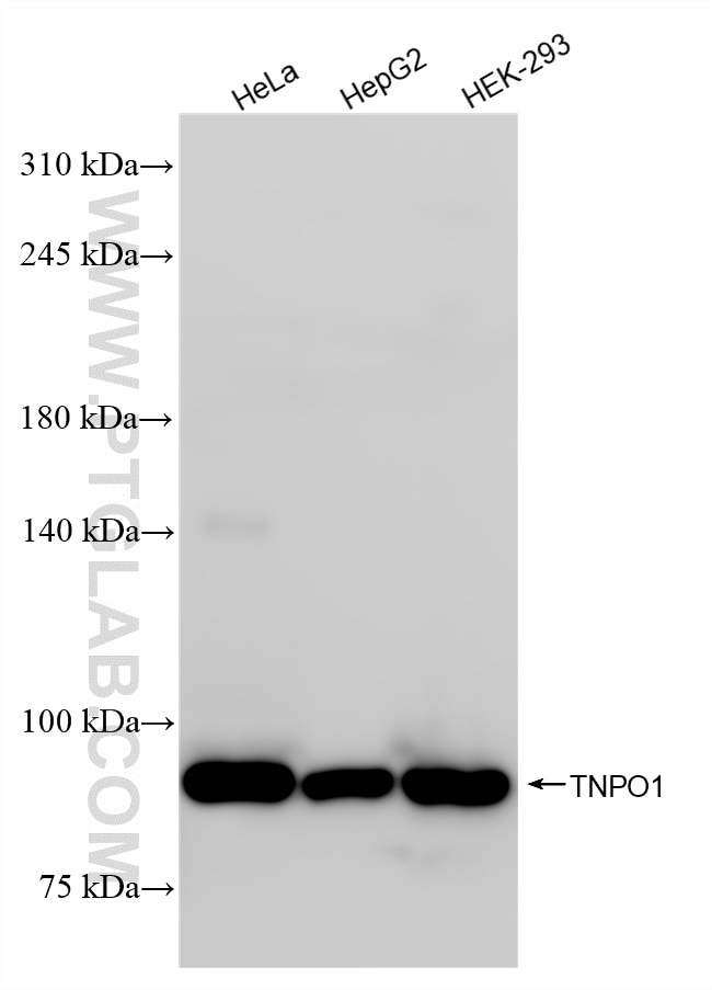 Western Blot (WB) analysis of various lysates using TNPO1 Recombinant antibody (85007-1-RR)