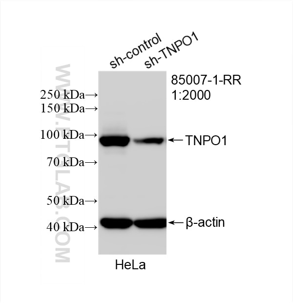 Western Blot (WB) analysis of HeLa cells using TNPO1 Recombinant antibody (85007-1-RR)